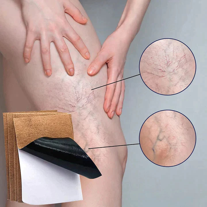 Varipro™ - Parche para Varices ( PACK 10 UNIDADES ) 🎁ESPECIAL ULTIMO DIA 2x1🎁