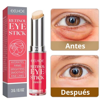 Retinol Eye Stick - Elimina Ojeras y Bolsas